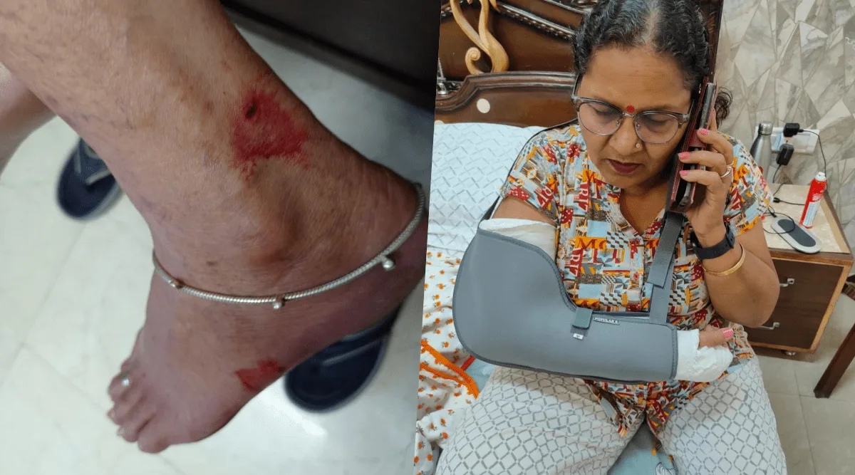 Panchkula Dog Attack Warning As Woman Bitten Twice